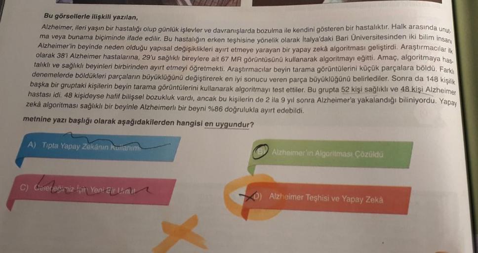 Bu görsellerle ilişkili yazılan,
Alzheimer, ileri yaşın bir hastalığı olup günlük işlevler ve davranışlarda bozulma ile kendini gösteren bir hastalıktır. Halk arasında unut-
ma veya bunama biçiminde ifade edilir. Bu hastalığın erken teşhisine yönelik olara