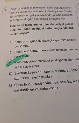 1.
Erkek gonadları olan testisler, karın boşluğunun di-
şında skrotum adı verilen bir torbada yer alır. Testis-
ler, embriyonun gelişim evresinde karın boşluğunda
bulunur ve doğum sonrasında skrotuma iner.
insanlarda testislerin skrotumda faaliyet göster-