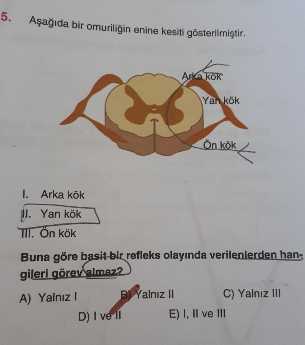 5.
Aşağıda bir omuriliğin enine kesiti gösterilmiştir.
1. Arka kök
. Yan kök
TII. Ön kök
A) Yalnız I
B) Yalnız II
Arka kök
Buna göre basit bir refleks olayında verilenlerden han-
gileri görev almaz?
D) I ve II
Yan kök
Ön kök
C) Yalnız III
E) I, II ve III