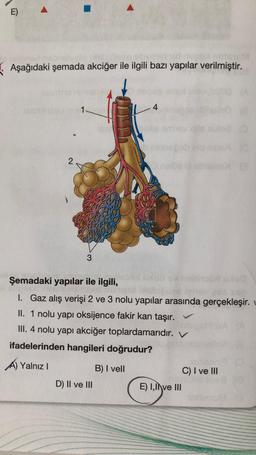 E)
Aşağıdaki şemada akciğer ile ilgili bazı yapılar verilmiştir.
2
3
4
Şemadaki yapılar ile ilgili,
aus ssp
I. Gaz alış verişi 2 ve 3 nolu yapılar arasında gerçekleşir.
II. 1 nolu yapı oksijence fakir kan taşır. ✓
III. 4 nolu yapı akciğer toplardamarıdır. V
ifadelerinden hangileri doğrudur?
A) Yalnız I
D) II ve III
B) I vell
E) I,II ve III
(0
C) I ve III