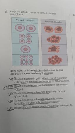 17. Aşağıdaki şekilde normal ve kanserli hücreler
gösterilmiştir.
Normal Hücreler
DO
Kanserli Hücreler
Buna göre, bu hücrelerin karşılaştırılması ile ilgili
aşağıdaki ifadelerden hangisi yanlıştır?
Kanserli hücrelerin çekirdekleri, normal hücrelerin
çekirdeklerinden farklı şekle sahip ve daha büyüktür.
B) Kanserli hücreler normal hücrelerden daha yavaş
bölünür.
Kanserli hücrelerin boyutları birbirinden farklılık
gösterebilir.
D) Kanserli hücrelerin kromozomlarında sayıca
farklılıklar ve yapısal bozulmalar gözlenir.
E) Kanserli hücrelerde organellerin sekilleri düzensizdir.
19