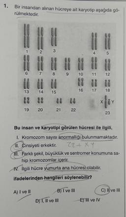 1. Bir insandan alınan hücreye ait karyotip aşağıda gö-
rülmektedir.
1
2
13
14
tt
22 22
19
A) I ve II
20
3
8 9
15
21
22
B) I ve III
D) I, II ve III
|||
4
10 11 12
18
16
5
11
17 18
X
Bu insan ve karyotipi görülen hücresi ile ilgili,
I. Kromozom sayısı anormalliği bulunmamaktadır.
11. Cinsiyeti erkektir.
22+XY
Hil. Farklı şekil, büyüklük ve sentromer konumuna sa-
hip kromozomlar içerir.
IV. ilgili hücre yumurta ana hücresi olabilir.
ifadelerinden hangileri söylenebilir?
E) III ve IV
23
Y
C) II ve III