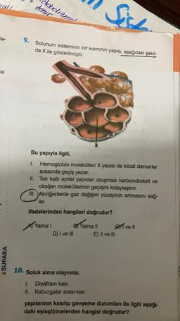 u-
na
$SUPARA
10.
Sist
9. Solunum sisteminin bir kısmının yapısı, aşağıdaki şekil-
de X ile gösterilmiştir.
denir
abolizma
Bu yapıyla ilgili,
1.
Hemoglobin molekülleri X yapısı ile kılcal damarlar
arasında geçiş yapar.
II. Tek katlı epitel yapıdan oluşması karbondioksit ve
oksijen moleküllerinin geçişini kolaylaştırır.
III. Akciğerlerde gaz değişim yüzeyinin artmasını sağ-
lar.
ifadelerinden hangileri doğrudur?
Yalnız I
D) I ve III
By Yalnız II
Soluk alma olayında;
1. Diyafram kası
II. Kaburgalar arası kas
E) II ve III
I ve II
yapılarının kasılıp gevşeme durumları ile ilgili aşağı-
daki eşleştirmelerden hangisi doğrudur?