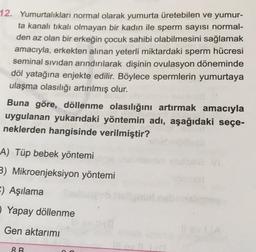 12. Yumurtalıkları normal olarak yumurta üretebilen ve yumur-
ta kanalı tıkalı olmayan bir kadın ile sperm sayısı normal-
den az olan bir erkeğin çocuk sahibi olabilmesini sağlamak
amacıyla, erkekten alınan yeterli miktardaki sperm hücresi
seminal sıvıdan arındırılarak dişinin ovulasyon döneminde
döl yatağına enjekte edilir. Böylece spermlerin yumurtaya
ulaşma olasılığı artırılmış olur.
Buna göre, döllenme olasılığını artırmak amacıyla
uygulanan yukarıdaki yöntemin adı, aşağıdaki seçe-
neklerden hangisinde verilmiştir?
A) Tüp bebek yöntemi
3) Mikroenjeksiyon yöntemi
-) Aşılama
O Yapay döllenme
Gen aktarımı
8 B