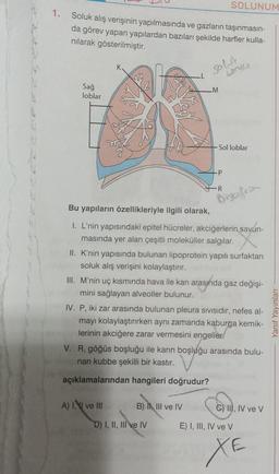 1. Soluk alış verişinin yapılmasında ve gazların taşınmasın-
da görev yapan yapılardan bazıları şekilde harfler kulla-
nılarak gösterilmiştir.
Sağ
loblar
K
_M
SOLUNUM
A) I ve III
-P
LOND
Sol loblar
Bu yapıların özellikleriyle ilgili olarak,
I. L'nin yapısındaki epitel hücreler, akciğerlerin savun-
masında yer alan çeşitli moleküller salgılar.
B) I, III ve IV
II. K'nin yapısında bulunan lipoprotein yapılı surfaktan
soluk alış verişini kolaylaştırır.
D) I, II, III ve IV
-R
Diyafra
III. M'nin uç kısmında hava ile kan arasında gaz değişi-
mini sağlayan alveoller bulunur.
IV. P, iki zar arasında bulunan pleura sivisidir, nefes al-
mayı kolaylaştırırken aynı zamanda kaburga kemik-
lerinin akciğere zarar vermesini engeller.
V. R, göğüs boşluğu ile karın boşluğu arasında bulu-
nan kubbe şekilli bir kastır.
açıklamalarından hangileri doğrudur?
C) II, IV ve V
E) I, III, IV ve V
XE
Yanıt Yayınları