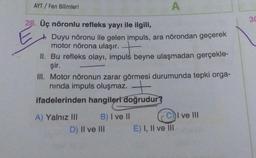 AYT / Fen Bilimleri
28. Üç nöronlu refleks yayı ile ilgili,
Duyu nöronu ile gelen impuls, ara nörondan geçerek
motor nörona ulaşır.
II. Bu refleks olayı, impuls beyne ulaşmadan gerçekle-
şir.
A
III. Motor nöronun zarar görmesi durumunda tepki orga-
nında impuls oluşmaz. +
ifadelerinden hangileri doğrudur?
A) Yalnız III
B) I ve II
D) II ve III
E) I, II ve III
I ve III
30