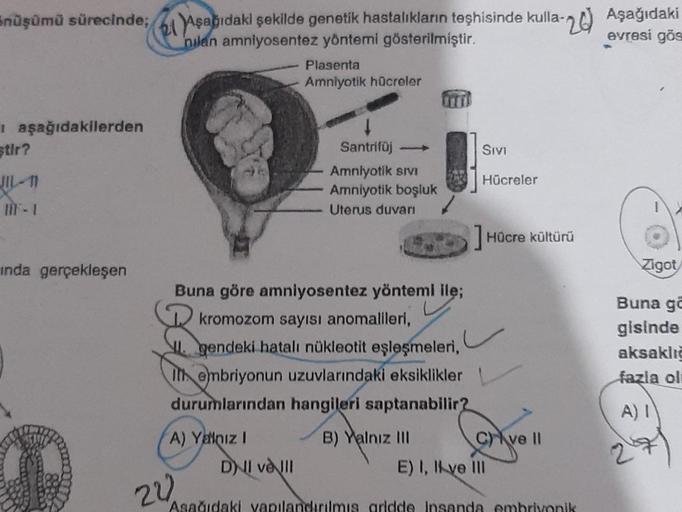 önüşümü sürecinde;
aşağıdakilerden
stir?
MF-T
inda gerçekleşen
21 Aşağıdaki şekilde genetik hastalıkların teşhisinde kulla- Aşağıdaki
nilan amniyosentez yöntemi gösterilmiştir.
evresi gös
A) Yalnız I
Plasenta
Amniyotik hücreler
222
Santrifüj
Amniyotik sıvı