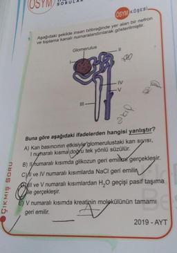 ÇIKMIŞ SORU
(OSYM) SOF
1.
SORU
OSYM KOSESI
Aşağıdaki şekilde insan böbreğinde yer alan bir nefron
ve toplama kanalı numaralandırılarak gösterilmiştir.
Glomerulus
III-
IV
diae
Buna göre aşağıdaki ifadelerden hangisi yanlıştır?
A) Kan basıncının etkisiyle glomerulustaki kan sıyısı,
I numaralı kısma doğru tek yönlü süzülür.
B) Inumaralı kısımda glikozun geri emil gerçekleşir.
C)/I ve IV numaralı kısımlarda NaCl geri emili
ll ve V numaralı kısımlardan H₂O geçişi pasif taşıma
ile gerçekleşir.
E) V numaralı kısımda kreatinin molekülünün tamamı
geri emilir.
2019 - AYT