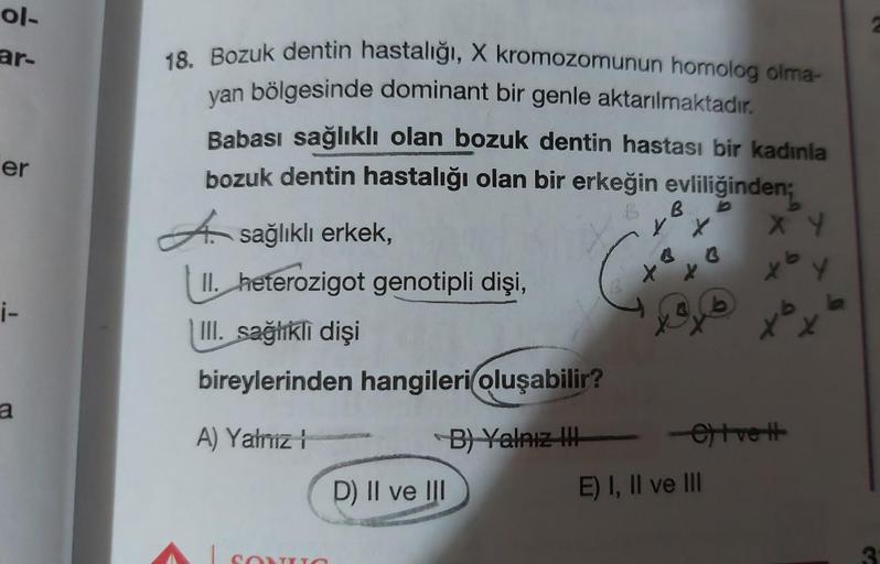 ol-
ar-
er
i-
a
18. Bozuk dentin hastalığı, X kromozomunun homolog olma-
yan bölgesinde dominant bir genle aktarılmaktadır.
Babası sağlıklı olan bozuk dentin hastası bir kadınla
bozuk dentin hastalığı olan bir erkeğin evliliğinden;
B b
A sağlıklı erkek,
II