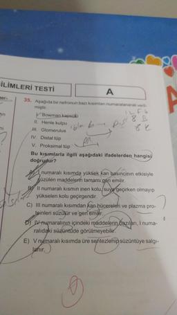 İLİMLERİ TESTİ
er-
in
ni
?
35. Aşağıda bir nefronun bazı kısımları numaralanarak veril-
miştir.
12 Fe
8B
Bowman kapsülü
A
II. Henle kulpu
H. Glomerulus
IV. Distal tüp
V. Proksimal tüp
Bu kısımlarla ilgili aşağıdaki ifadelerden hangisi
doğrudur?
oblar bo
pis
82
numaralı kısımda yüksek kan basıncının etkisiyle
süzülen maddelerin tamamı geri emilir.
Il numaralı kısmın inen kolu, suya geçirken olmayıp
yükselen kolu geçirgendir.
C) III numaralı kısımdan kan hücereleri ve plazma pro-
teinleri süzülür ve geri emilir.
DIV numaralının içindeki maddelerin bazıları, I numa-
ralıdaki süzüntüde görülmeyebilir.
E) V numaralı kısımda üre sentezlenip süzüntüye salgı-
lanır.