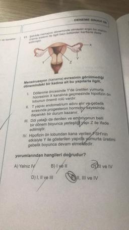 ve kanallar
DENEME SINAVI 09
11. Şekilde menapoz döneminde olmayan ergin bir dişinin
üreme sistemi ile ilgili bazı bölümler harflerle ifade
edilmiştir
Menstruasyon (kanama) evresinin görülmediği
dönemindeki bir kadına ait bu yapılarla ilgili,
1.
Döllenme öncesinde Y'de üretilen yumurta
hücresinin X kanalına geçmesinde hipofizin ön
lobunun önemli rolü vardır.
II. T yapısı endometrium adını alır ve gebelik
sırasında progesteron hormonu sayesinde
dayanıklı bir durum kazanır.
III. Döl yatağı da denilen ve embriyonun belli
bir dönem boyunca yerleştiği yapı Z ile ifade
edilmiştir.
IV. Hipofizin ön lobundan kana verilen FSH'nin
etkisiyle Y ile gösterilen yapıda yumurta üretimi
gebelik boyunca devam etmektedir.
yorumlarından hangileri doğrudur?
A) Yalnız IV
B) I
B) I ve II
D) I, II ve III
Cll ve IV
II, III ve IV