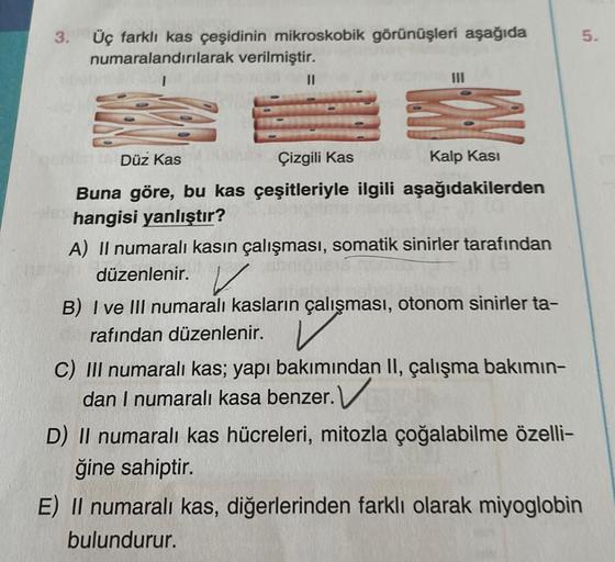 3.
Üç farklı kas çeşidinin mikroskobik görünüşleri aşağıda
numaralandırılarak verilmiştir.
Düz Kas
|||
Çizgili Kas
Kalp Kası
Buna göre, bu kas çeşitleriyle ilgili aşağıdakilerden
hangisi yanlıştır?
URG
A) II numaralı kasın çalışması, somatik sinirler taraf