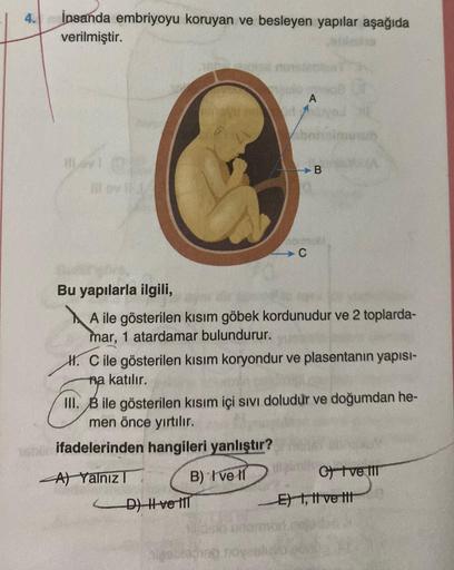 4.
insanda embriyoyu koruyan ve besleyen yapılar aşağıda
verilmiştir.
11,691
C
A
D) ve 111
B
Bu yapılarla ilgili,
ile gösterilen kısım göbek kordunudur ve 2 toplarda-
mar, 1 atardamar bulundurur.
H. C ile gösterilen kısım koryondur ve plasentanın yapısı-
n