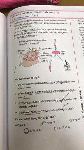 SİSTEMİ VE EMBRİYONİK GELİŞİM
Onite Değerlendirme Testi-2
DREME
5.
Gebelik sürecinde hem anne hem de çocuk tibbi olarak kont-
rol altında tutulmalıdır. Çocuğun gelişimi ultrason cihazı ile
kontrol edilmektedir.
Ultrason tetkiklerinde fetüste bir anormallik