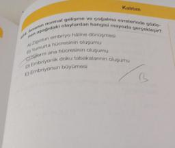 Kalıtım
464. Insanin normal gelişme ve çoğalma evrelerinde gözle-
aşağıdaki olaylardan hangisi mayozla gerçekleşir?
A) Zigotun embriyo háline dönüşmesi
B) Yumurta hücresinin oluşumu
C)Sperm ana hücresinin oluşumu
D) Embriyonik doku tabakalarının oluşumu
E) Embriyonun büyümesi
nen
B