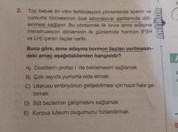 2. Tüp bebek (in vitro fertilizasyon) yönteminde sperm ve
yumurta hücrelerinin özel laboratuvar şartlarında döl-
lenmesi sağlanır. Bu yöntemde ilk önce anne adayına
menstruasyon döneminin ilk günlerinde hormon (FSH
ve LH) içeren ilaçlar verilir.
Buna göre, anne adayına hormon ilaçları verilmesin-
deki amaç aşağıdakilerden hangisidir?
A) Oositlerin profaz l 'de beklemesini sağlamak
B) Çok sayıda yumurta elde etmek
C) Uterusu embriyonun gelişebilmesi için hazır hale ge-
tirmek
D) Süt bezlerinin çalışmasını sağlamak
E) Korpus luteum oluşumunu hızlandırmak
-e
ANTIKOR
C
LO
5