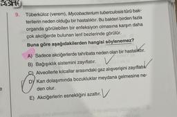 23
9. Tüberküloz (verem), Mycobacterium tuberculosis türü bak-
terilerin neden olduğu bir hastalıktır. Bu bakteri birden fazla
organda görülebilen bir enfeksiyon olmasına karşın daha
çok akciğerde bulunan lenf bezlerinde görülür.
Buna göre aşağıdakilerden hangisi söylenemez?
A) Sadece akciğerlerde tahribata neden olan bir hastalıktır.
SINIBY (A
B) Bağışıklık sistemini zayıflatır.
viva Ill
Alveollerle kılcallar arasındaki gaz alışverişini zayıflatı
DY Kan dolaşımında bozukluklar meydana gelmesine ne-
den olur.
E) Akciğerlerin esnekliğini azaltır.
·V
ised eoniesie imingel O obnabiting bish gopA