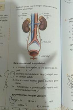 nlar
ak
anda okla-
oleküller-
si yanlış-
na
ak
at
onu
=
onu
6
11. Aşağıdaki şekilde insan böbreğine ait damarlar ve idrar
kanalları gösterilmiştir.
10
Böbrek
toplardamarı
7
Buna göre, numaralı kısımlarla ilgili,
I. 1 numaralı Kısım oksijen ve üre bakımından zen-
gindir.
Böbrek
atardamarı
A) Yalnız IV
Üreter (3
3 numaralı kısımda bulunan üre yoğunluğu 2 numa-
ralı kısımdan fazladır.
III. 3 ve 4 numaralı kısımlar sağlıklı bireylerde glikoz
içemez.
Mesane
IV. 1 numaralı kısımda glikoz bulunduğu halde 2 numa-
ralı kısımlarda bulunmaz.
açıklamalarından hangileri yanlıştır?
B) I ve II
D) III ve IV
8
A
C) I ve III
E) II, III ve IV
2.
idrar
salgı
I. S
III. S
b
açık
A) Y
3. Vü
m
C
A