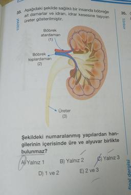 33. Aşağıdaki şekilde sağlıklı bir insanda böbreğe
ait damarlar ve idrarı, idrar kesesine taşıyan
üreter gösterilmiştir.
ybb353
Böbrek
atardamarı
(1)
Böbrek
toplardamarı
(2)
Üreter
(3)
Şekildeki numaralanmış yapılardan han-
gilerinin içerisinde üre ve alyuvar birlikte
bulunmaz?
Al Yalnız 1
D) 1 ve 2
B) Yalnız 2
E) 2 ve 3
Yalnız 3
35. C
53nbor
final dergisi