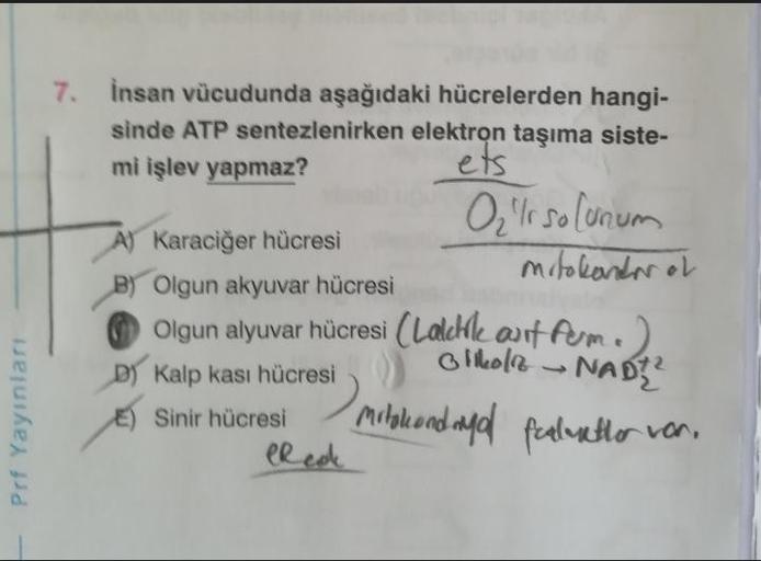 Prf Yayınları
7. İnsan vücudunda aşağıdaki hücrelerden hangi-
sinde ATP sentezlenirken elektron taşıma siste-
mi işlev yapmaz?
ets
O₂ Ir solunum
mitokonder of
A) Karaciğer hücresi
B) Olgun akyuvar hücresi
Olgun alyuvar hücresi (Lalchile ant form.
Glikola
D