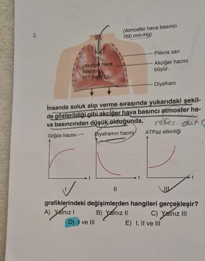 2.
(Akciğer hava
basıncı
757 mm Hg)
(Atmosfer hava basıncı
760 mm-Hg)
||
D) I ve III
İnsanda soluk alıp verme sırasında yukarıdaki şekil-
de gösterildiği gibi akciğer hava basıncı atmosfer ha-
refer duar
va basıncından düşük olduğunda,
Göğüs hacmi
Diyafram