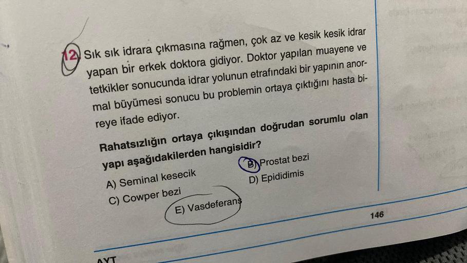 Sık sık idrara çıkmasına rağmen, çok az ve kesik kesik idrar
yapan bir erkek doktora gidiyor. Doktor yapılan muayene ve
tetkikler sonucunda idrar yolunun etrafındaki bir yapının anor-
mal büyümesi sonucu bu problemin ortaya çıktığını hasta bi-
reye ifade e