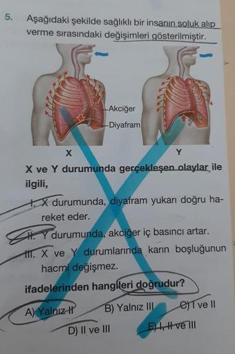 5. Aşağıdaki şekilde sağlıklı bir insanın soluk alıp
verme sırasındaki değişimleri gösterilmiştir.
X
Akciğer
-Diyafram
X ve Y durumunda gerçekleşen olaylar ile
ilgili,
Y
X durumunda, diyafram yukarı doğru ha-
reket eder.
HY durumunda, akciğer iç basıncı ar