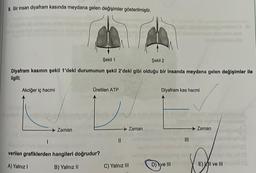 8. Bir insan diyafram kasında meydana gelen değişimler gösterilmiştir.
Şekil 1
Şekil 2
Diyafram kasının şekil 1'deki durumunun şekil 2'deki gibi olduğu bir insanda meydana gelen değişimler ile
ilgili;
Akciğer iç hacmi
Zaman
Üretilen ATP
verilen grafiklerden hangileri doğrudur?
A) Yalnız I
B) Yalnız II
||
Zaman
C) Yalnız III
Diyafram kas hacmi
D) ve III
=
Zaman
E) Il ve Ill