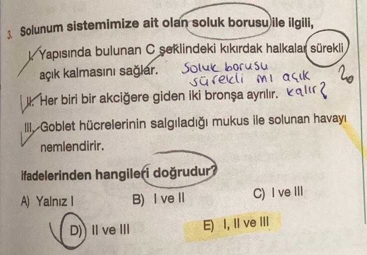 3. Solunum sistemimize ait olan soluk borusu ile ilgili,
✓Yapısında bulunan C şeklindeki kıkırdak halkalar sürekli,
açık kalmasını sağlar.
Soluk borusu
sürekli mi açık
20
Her biri bir akciğere giden iki bronşa ayrılır. Kalır?
III Goblet hücrelerinin salgıl