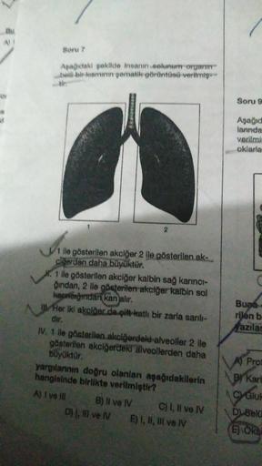 Soru 7
Aşağıdaki şekilde insanın solunum organın
belli bir kısmının şematik görüntüsü verilmiş
1 ile gösterilen akciğer 2 ile gösterilen ak-
cilerden daha büyüktür.
2
X. 1 ile gösterilen akciğer kalbin sağ karıncı-
ğından, 2 lle gösterilen akciğer kalbin s