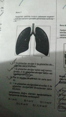 Soru 7
Aşağıdaki şekilde insanın solunum organın
belli bir kısmının şematik görüntüsü verilmiş
1 ile gösterilen akciğer 2 ile gösterilen ak-
cilerden daha büyüktür.
2
X. 1 ile gösterilen akciğer kalbin sağ karıncı-
ğından, 2 lle gösterilen akciğer kalbin sol
kepnorğından kan alır.
Her iki akciğer de çift katlı bir zarla sarılı-
dir.
IV. 1 ile gösterilen akciğerdeki alveoller 2 ile
gösterilen akciğerdeki alveollerden daha
büyüktür.
yargılanının doğru olanlanı aşağıdakilerin
hangisinde birlikte verilmiştir?
A) I ve ill
B) II ve IV
D), Il ve IV
C) I, II ve IV
E) I, II, III ve IV
Soru 9
Aşağıd
lanında
verilmi
oklarla
Bupa
rilen b
azılar
A) Prot
By Kare
C Glut
D) Bel
E) OKSE