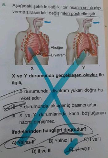 5. Aşağıdaki şekilde sağlıklı bir insanın soluk alıp
verme sırasındaki değişimleri gösterilmiştir.
X
Akciğer
-Diyafram
X ve Y durumunda gerçekleşen olaylar ile
ilgili,
X durumunda, diyafram yukarı doğru ha-
reket eder.
A) Yalnız I
Y
HY durumunda, akciğer i