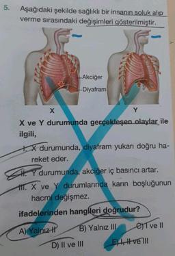 5. Aşağıdaki şekilde sağlıklı bir insanın soluk alıp
verme sırasındaki değişimleri gösterilmiştir.
X
Akciğer
-Diyafram
X ve Y durumunda gerçekleşen olaylar ile
ilgili,
X durumunda, diyafram yukarı doğru ha-
reket eder.
A) Yalnız I
Y
HY durumunda, akciğer iç basıncı artar.
H. X ve Y durumlarında karın boşluğunun
hacmi değişmez.
ifadelerinden hangileri doğrudur?
B) Yalnız III
D) II ve III
e) I ve Il
E) , #vell