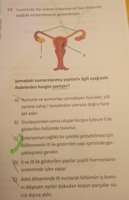 19. İnsanlarda dişi üreme sistemine ait bazı bölümler
aşağıda numaralanarak gösterilmiştir.
|||
Şemadaki numaralanmış yapılarla ilgili aşağıdaki
ifadelerden hangisi yanlıştır?
A) Yumurta ve yumurtayı çevreleyen hücreler, silli
epitele sahip I kanalından uterusa doğru hare-
ket eder.
B) Ovulasyondan sonra oluşan korpus luteum II ile
gösterilen bölümde bulunur.
C) Embriyonun sağlıklı bir şekilde gelişebilmesi için
döllenmenin III ile gösterilen yapı içerisinde ger-
çekleşmesi gerekir.
D) II ve III ile gösterilen yapılar çeşitli hormonların
üretiminde işlev yapar.
E) Adet döneminde III numaralı bölümün iç kısmı-
nı döşeyen epitel dokudan kopan parçalar vü-
cut dışına atılır.