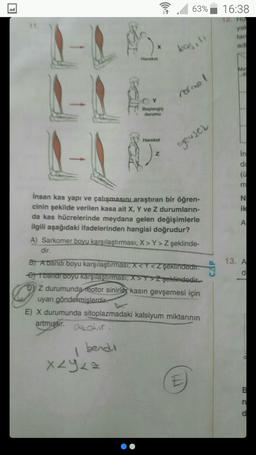 11.
((.*
L
Hareket
1-1 45
Z
1
x2y<=
Y
Başlangıç
durumu
63% 16:38
kas.!!
normal
geusel
insan kas yapı ve çalışmasını araştıran bir öğren-
cinin şekilde verilen kasa ait X, Y ve Z durumların-
da kas hücrelerinde meydana gelen değişimlerle
ilgili aşağıdaki ifadelerinden hangisi doğrudur?
A) Sarkomer boyu karşılaştırması; X> Y> Z şeklinde-
dir.
B) A bandı boyu karşılaştırması, X<Y<Z şeklindedir.
etbandi boyu karşılaştırması; X>Y>Zşeklindedir.
DZ durumunda motor sinirley kasın gevşemesi için
uyarı göndermişlerdir.
E) X durumunda sitoplazmadaki kalsiyum miktarının
artmiştir. alır.
bendi
Ⓒ
yal
ad
Me
in
da
(C
CENA
m
ik
13. A
d
E
n
d