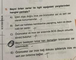 HIZ VE RENK YAYINLARI
5. Beyni örten zarlar ile ilgili aşağıdaki yargılarından
hangisi yanlıştır?
A) İçten dışa doğru ince zar-örümceksi zar ve sert zar
olarak konumlanırlar. +
B) Sert zar kafatası kemiklerine yapışmış, kalın ve daya-
nıklı bir zardır.
+
ADD
C) Örümceksi ve ince zar arasında BOS (Beyin omurilik
SIVISI) bulunur. +
D Beyni besleyen kılcal kan damarları örümceksi zar
üzerindedir.
1
E) Örümceksi zar ince bağ dokusu iplikleriyle ince ve
elpac
sert zarı birbirine bağlar. T