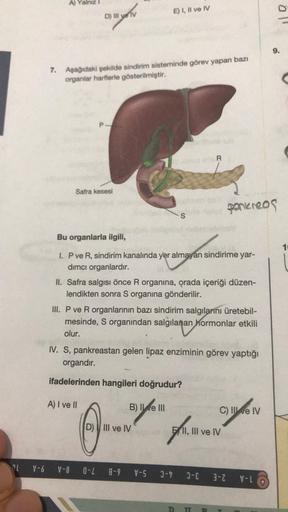 OL
V-6
A)
7. Aşağıdaki şekilde sindirim sisteminde görev yapan bazı
organlar harflerle gösterilmiştir.
Safra kesesi
D) Ill ye v
A) I ve II
Q
E) I, II ve IV
Bu organlarla ilgili,
I. P ve R, sindirim kanalında yer almayan sindirime yar-
amyran shnd
dimci org