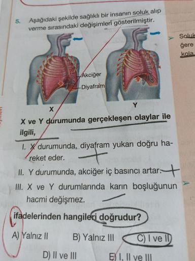 5. Aşağıdaki şekilde sağlıklı bir insanın soluk alıp
verme sırasındaki değişimleri gösterilmiştir.
X
Akciğer
Diyafram
X ve Y durumunda gerçekleşen olaylar ile
ilgili,
Y
1. X durumunda, diyafram yukarı doğru ha-
reket eder.
7
II. Y durumunda, akciğer iç bas