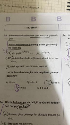 sentit lenney (Su Jensen)
H₂
B
B
11. SINIF
21. Pankreasın acinar hücreleri pankreas öz suyunu sal-
gilar.
Acinar hücrelerinin gerektiği kadar çalışmadığı
bir insanda;
alımı
A) Yalnız I
kilo kaybı,
- Sindritee
sindirim kanalında yağların sindiriminin hızlan