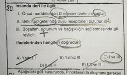 20.
L) Kulak Zall
Insanda deri ile ilgili;
1. Öncü maddelerden D vitamini üretimini sağlar.
WOME
II. Belirli bölgelerinde duyu reseptörleri bulunur.
III. Boşaltım, solunum ve bağışıklığın sağlanmasında gö-
revlidir. +
ifadelerinden hangileri doğrudur?
A) Yalnız 1
B) Yalnız III
E) I ve Ill
Mas
C) I ve III
D) Il ve III
Aşağıdaki göz kusurunda, P noktasında oluşması gereken