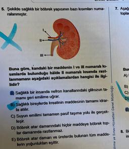 5. Şekilde sağlıklı bir böbrek yapısının bazı kısımları numa-
ralanmıştır.
X
Buna göre, kandaki bir maddenin I ve III numaralı kı-
sımlarda bulunduğu hâlde Il numaralı kısımda rast-
lanmaması aşağıdaki açıklamalardan hangisi ile ilgi-
lidir?
A) Sağlıklı bir insanda nefron kanallarındaki glikozun ta-
mamı geri emilime uğrar.
B) Sağlıklı bireylerde kreatinin maddesinin tamamı idrar-
la atılır.
C) Suyun emilimi tamamen pasif taşıma yolu ile gerçek-
leşir.
dirme ye Sınav Hizmetleri Genel Müdürlüğü
D) Böbrek atar damarındaki hiçbir maddeye böbrek top-
lar damarında rastlanmaz.
E) Böbrek atar damarı ve üreterde bulunan tüm madde-
lerin yoğunlukları eşittir.
7. Aşağ
topla
Bur
A)
BOD
B)
C)
D)
8. Bi
in