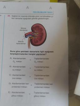 A
28. Sağlıklı bir insanda böbreğe giren ve böbrekten çı-
kan damarlar aşağıdaki şekilde gösterilmiştir.
Böbrek
atardamarı
Böbrek
toplardamarı
A
A) Atardamardaki
O₂ miktarı
Buna göre şekildeki damarlarla ilgili aşağıdaki
karşılaştırmalardan hangisi yapılamaz?
B) Atardamardaki
su miktarı
C) Atardamardaki
üre miktarı
D) Atardamardaki kan
proteinleri miktarı
E) Atardamardaki
glikoz miktarı
A
FEN BİLİMLERİ TESTİ
<
>
Toplardamardaki
O₂ miktarı
Toplardamardaki
su miktarı
Toplardamardaki
üre miktarı
Toplardamardaki kan
proteinleri miktarı
Toplardamardaki
glikoz miktarı