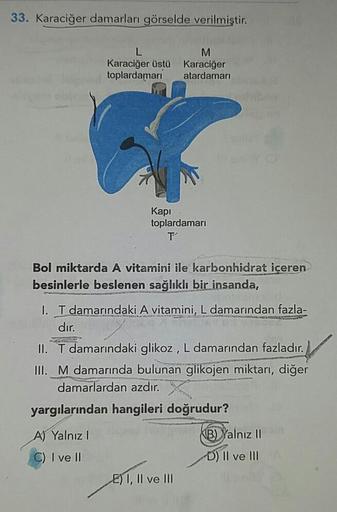 33. Karaciğer damarları görselde verilmiştir.
M
Karaciğer üstü
toplardamarı
Karaciğer
atardamari
Kapı
toplardamari
Bol miktarda A vitamini ile karbonhidrat içeren
besinlerle beslenen sağlıklı bir insanda,
I. T damarındaki A vitamini, L damarından fazla-
dı