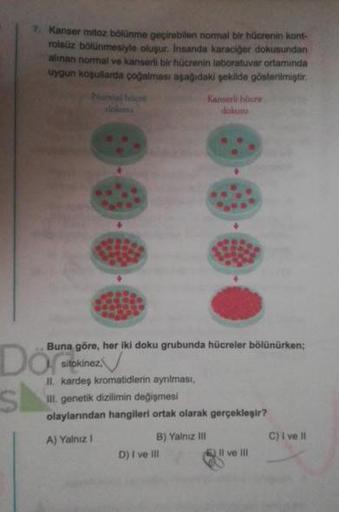 Kanser mitoz bölünme geçirebilen normal bir hücrenin kont-
rolsüz bölünmesiyle oluşur. Insanda karaciger dokusundan
alinan normal ve kanserli bir hücrenin laboratuvar ortamında
uygun koşullarda çoğalması aşağıdaki şekilde gösterilmiştir.
Nonne
Kanserli hüc