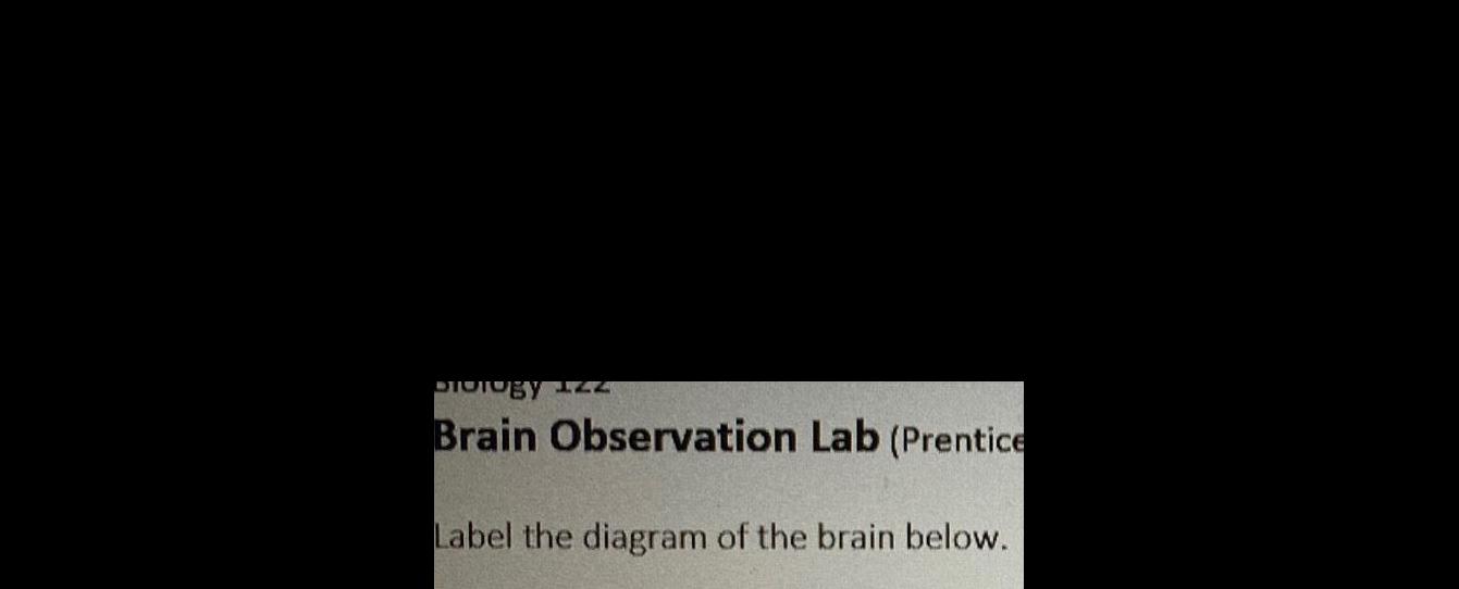 DIOTOE Brain Observation Lab Prentice Label the diagram of the brain below